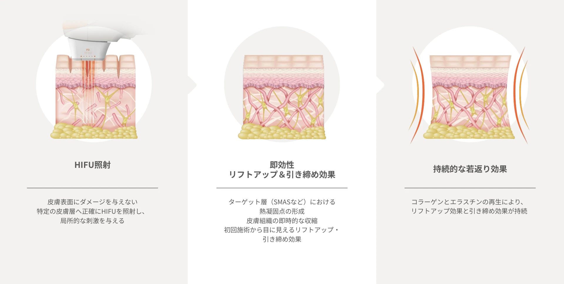 ダウンロード